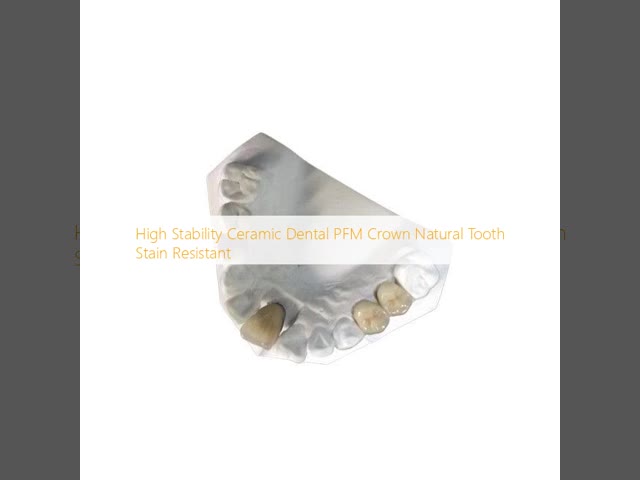 High Stability Ceramic Dental PFM Crown Natural Tooth Stain Resistant