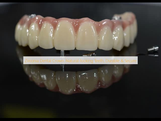 Zirconia Dental Crown: Natural-looking Teeth, Durable & Secure