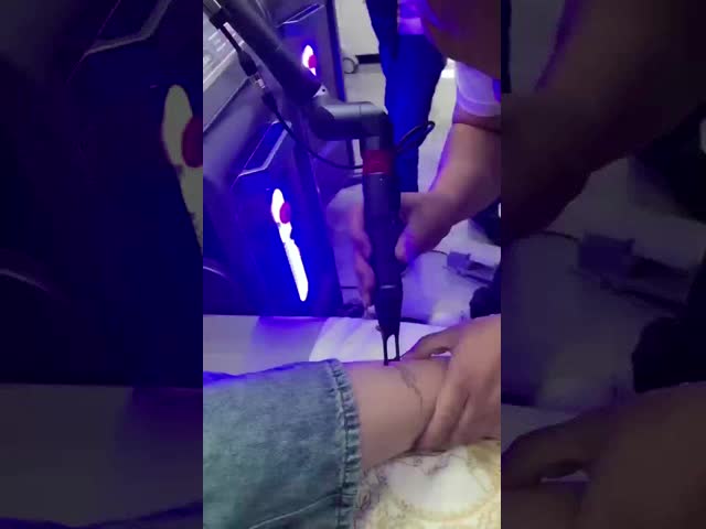 Painless Q Switch Tattoo Removal Machine Professional Tattoo Removal Machine 532nm