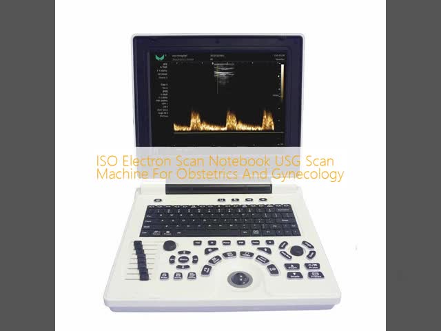 ISO Electron Scan Notebook USG Scan Machine For Obstetrics And Gynecology
