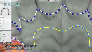 Hypoallergenic Adjustable And Customizable 3D Printed Titanium Framework With Modern Design