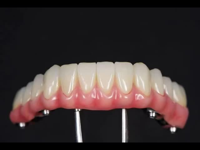 Class I AOX Implants All On 4 Hybrid Titanium Screw Retained Full Zirconia