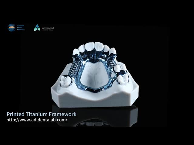 Hypoallergenic Adjustable And Customizable 3D Printed Titanium Framework With Modern Design