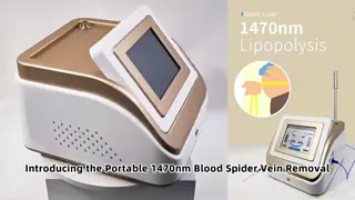 Portable 980nm Diode 1470 Laser Lipolysis Machine For Endolift