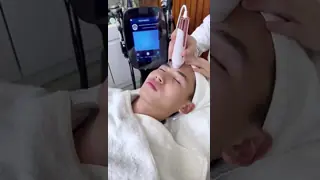 9 In 1 Hydro Co2 Bubble Oxygen Jet Peel Skin Rejuvenation RF Microdermabrasion Machine